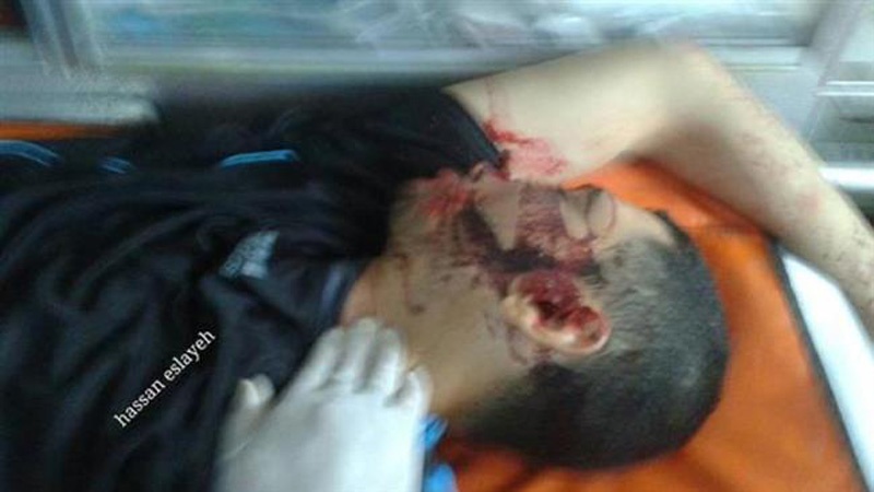 صیہونی حملے میں شہید ہونے والے فلسطینیوں کی تعداد چار ہوگئی