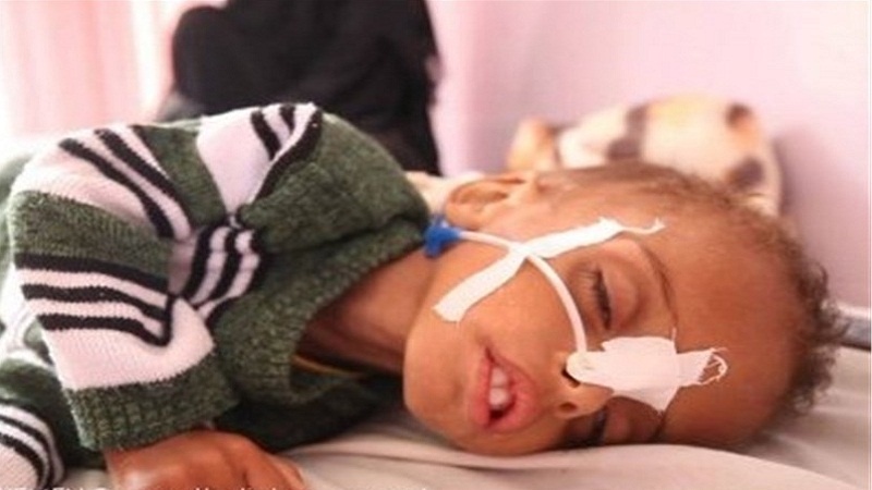 Bombardovana skladišta Svjetskog programa za hranu  u Jemenu