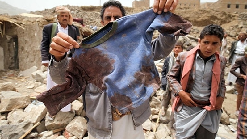 Jemenska djeca; žrtve zločina saudijske kraljevske porodice i šutnje Zapada 