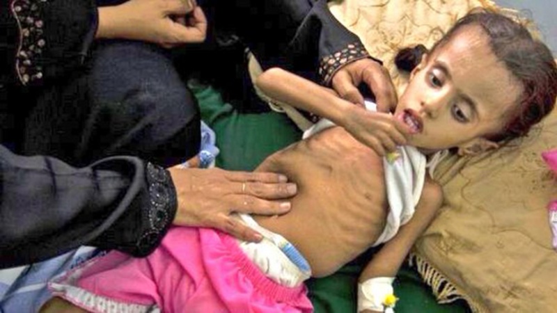 Fransa Yəmən xalqını qırmaqda Ərəbistana kömək edir