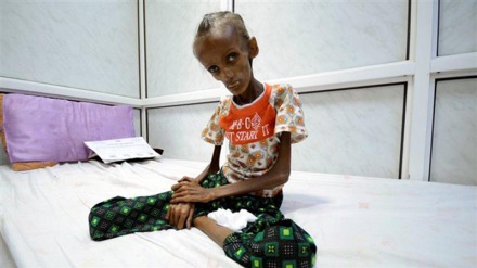 Milioni Jemenaca pate od nedostatka prehrambene sigurnosti