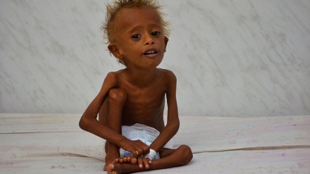 UNICEF upozorava na neuhranjenost jemenske djece