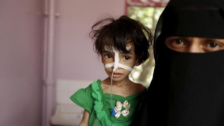 سعودی حملوں کے باعث یمنی بچے خوراک کی شدید قلت کا شکار 