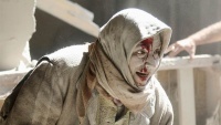 Jedna od preživjelih osoba iz sirijskog rata u Halebu