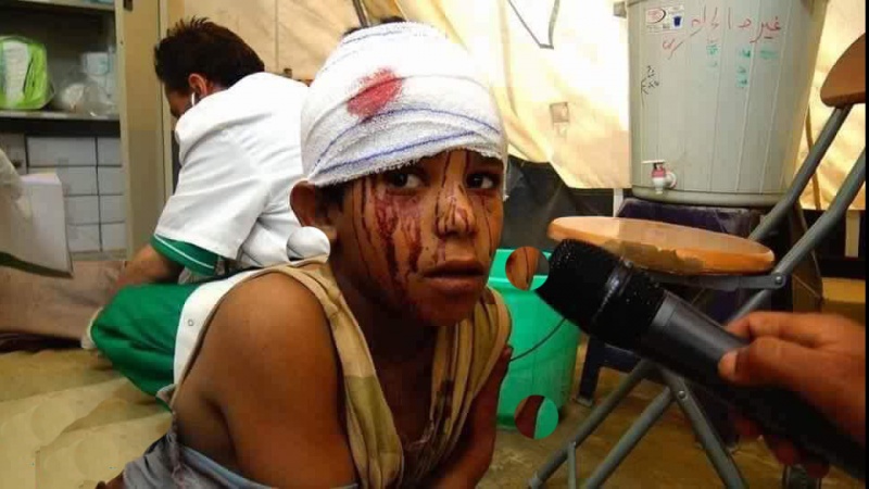 یمن پر وحشیانہ سعودی جارحیت، متعدد اسکولی بچے شہید 