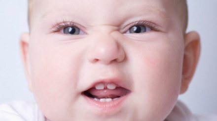 بچوں میں دانتوں کی عام بیماریاں - ویڈیو