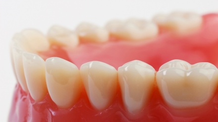 مەترسیی مەرگی پێش وەخت بە کڵۆر بوونی ددان