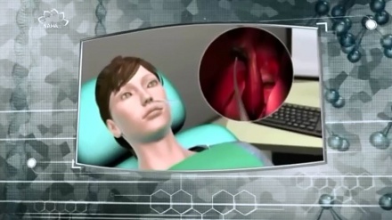 سائینو سرجری 