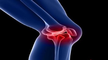 دەرمانەکانی ئازاری ئەژنۆ