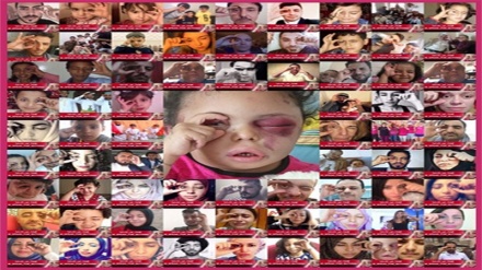 یمنی بچی جس نے لاکھوں آنکھیں کھول دیں ۔ تصاویر + ویڈیو