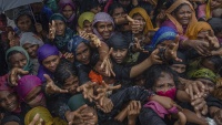 Liječenje opekotina muslimana Mijanmara u Bangladešu 
