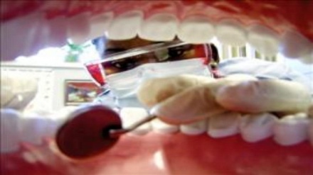  خوبصورت دانت