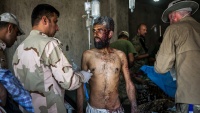 Ranjeni u ratu protiv DAIŠ-a u Iraku
