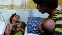 Sirijska djevojka u Dumi stavlja masku s kisikom na usta jednom novorođenčetu
