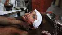 Jedan sirijski mladić (dječak) ranjen u istočnoj Guti