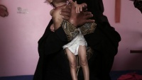 Gladna jemenska djeca na pragu smrti
