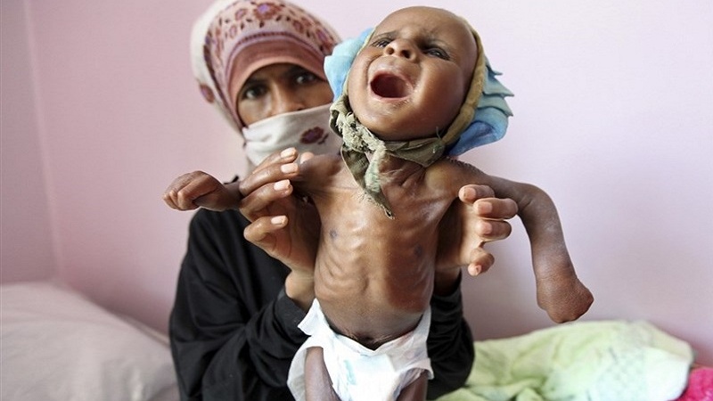 یمن میں قحط سالی کا خدشہ: اقوام متحدہ