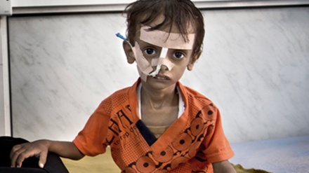 BMT: Səudiyyə koalisiyasının əl-Hüdəydəyə hücumunda 121 mindən çox insan didərgin düşüb