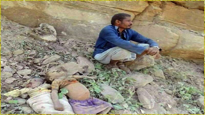 کربلائے یمن کی ایک دردناک تصویر !!!