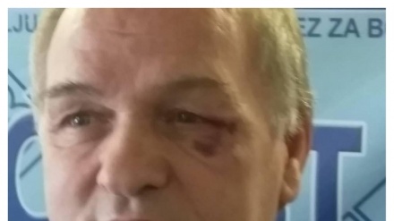 SBB: Kod Visokog napadnut poslanik u Predstavničkom domu Parlamenta FBiH