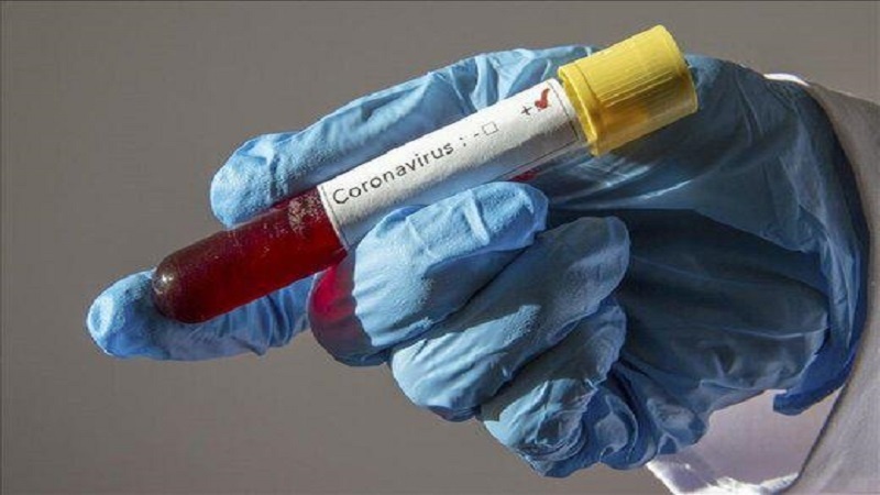 Hrvatska: Prvi slučaj korona virusa potvrđen u Zagrebu