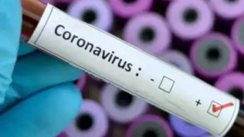 U Italiji od korona virusa umrlo 27 osoba