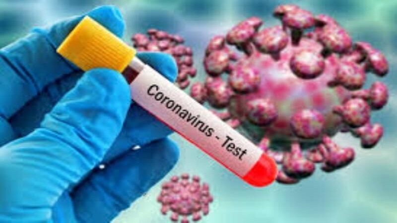 Azərbaycanda daha 544 nəfər koronavirusa yoluxdu
