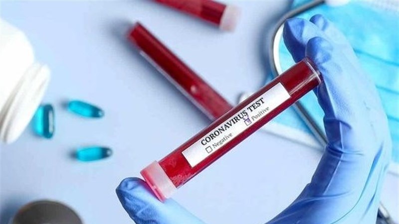 Dünyada son sutkada 570 mindən çox koronavirusa yoluxma faktı qeydə alınıb