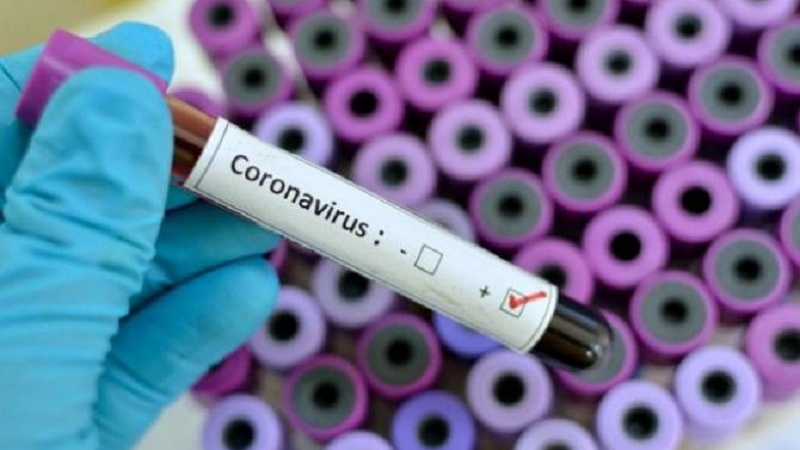 Türkiyədə bu gün koronavirusdan 20 nəfər ölüb