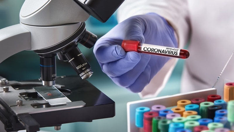 Azərbaycan Respublikasında 43 yeni koronavirus (COVID-19) infeksiyasına yoluxma faktı qeydə alınıb