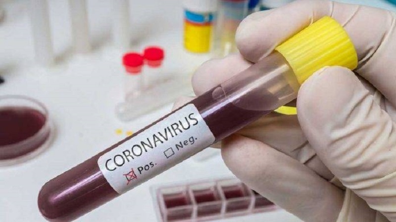 Alimlər ağır koronavirus xəstələrinin fərqli müalicəsini təklif edirlər