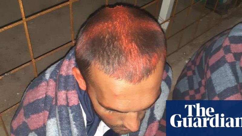 Guardian: EU prikriva torturu hrvatske policije nad migrantima