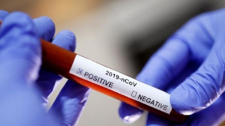 Azərbaycanda 262 yeni yoluxma , 2 nəfər ölüm faktı qeydə alınıb