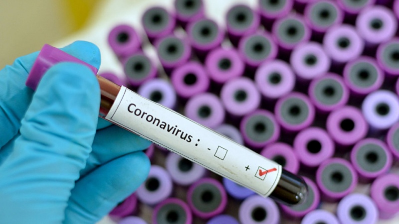 Dünyada koronavirus qurbanlarının sayı 350 mini ötdü