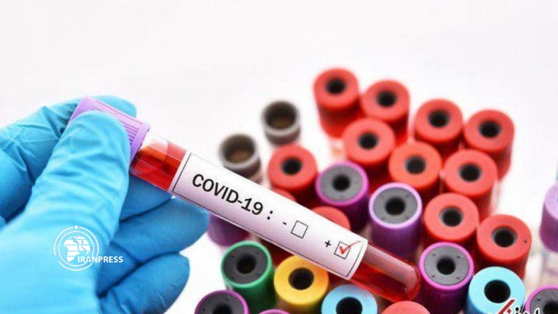 Ermənistanda koronavirusa yoluxanların sayı 29 mini keçdi  