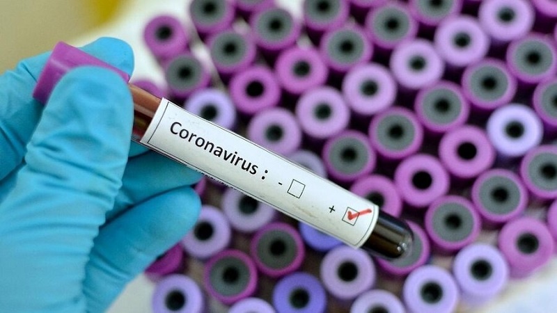 Gürcüstanda koronavirusa yoluxanların sayı 1 206 nəfərə çatıb