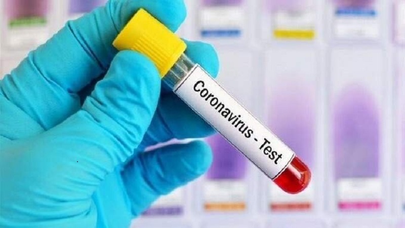 Gürcüstanda koronavirusa yoluxanların sayı 1 213 nəfərə çatıb