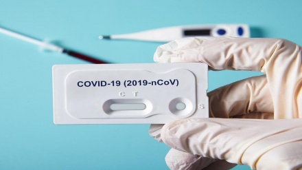 Azərbaycanda daha 583 nəfərdə COVID-19 aşkarlanıb, 7 nəfər vəfat edib