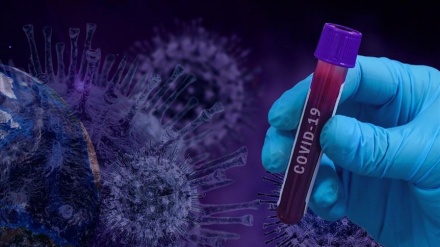 Azərbaycanda son sutkada 471 nəfər COVID-19-a yoluxub