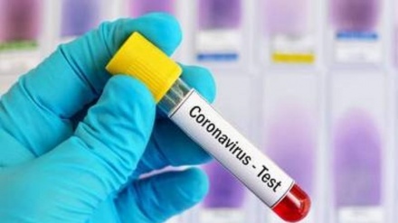 Ermənistanda koronavirusdan ölənlərin sayı 887-yə yüksəldi