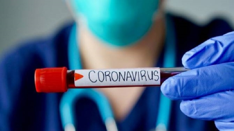 Ermənistanda son sutkada 392 nəfər koronavirusa yoluxub