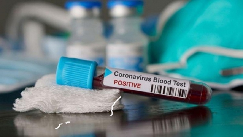 Türkiyədə son sutkada 15 nəfər koronavirusdan ölüb