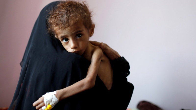 دس لاکھ سے زائد یمنی بچے آل سعود کے رحم و کرم پر، مایوسی کا امکان قوی