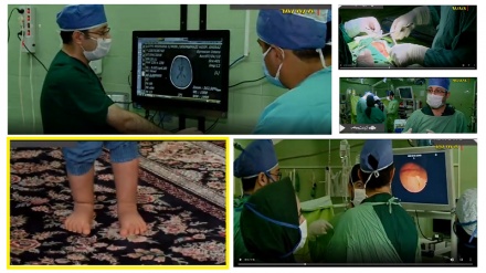 ایرانی ڈاکٹروں کا کمال، ایران، انتہائی پیچیدہ نیورو سرجری کرنے والا دنیا کا تیسرا ملک بن گیا