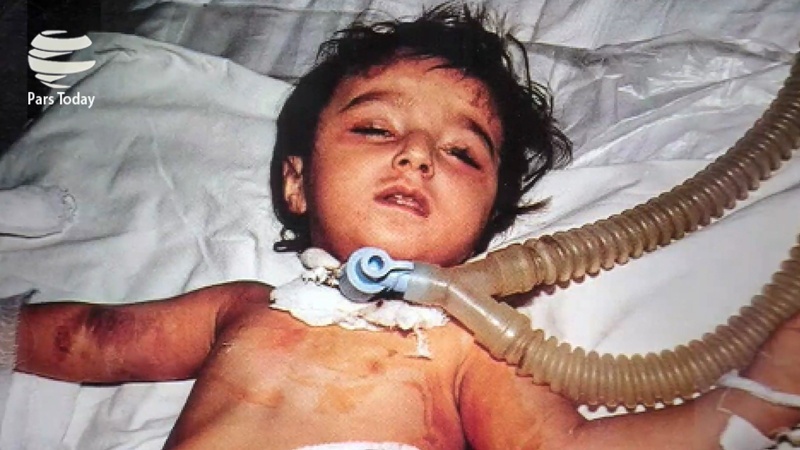 Zarif: Sardasht, simbol i përdorimit të armëve kimike kundër civilëve