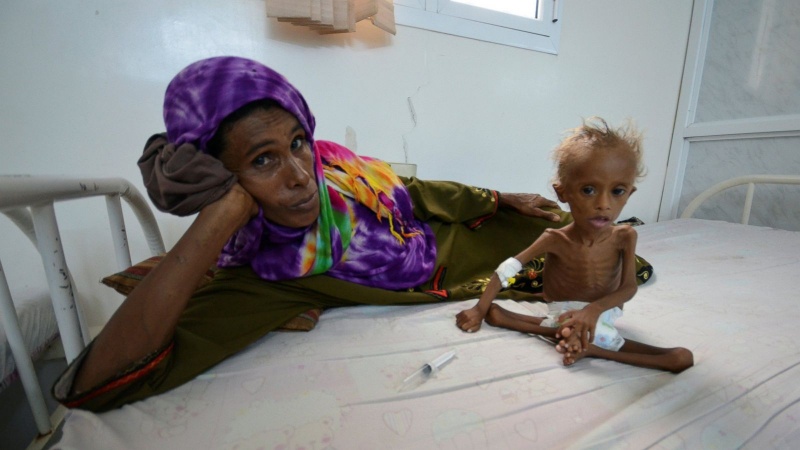 یمنی بچوں کی المناک صورتحال پر عالمی ادارہ صحت کا انتباہ 