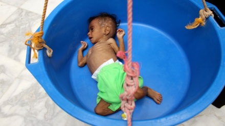 UNICEF: Çdo 10 minuta humb jetën një fëmijë në Jemen