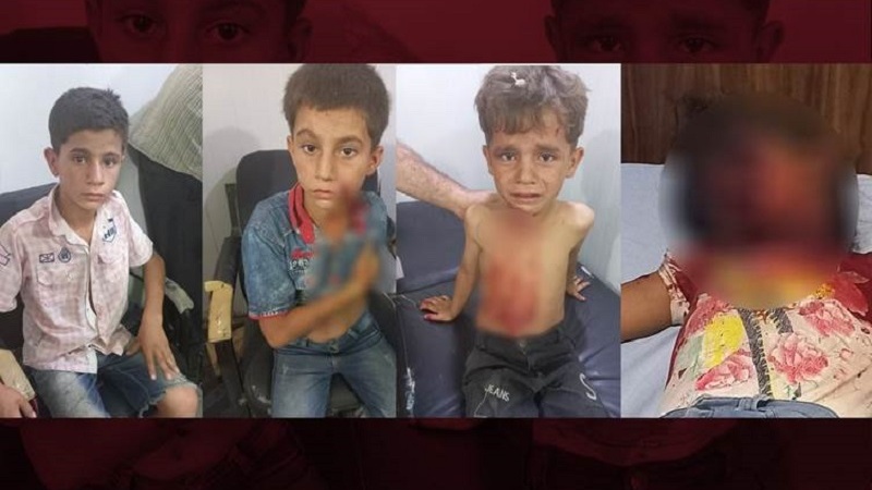 Li devera kurdî ya bakurê rojavayê Sûriyê mayînek teqiya 4 zarokan birîndar bûn