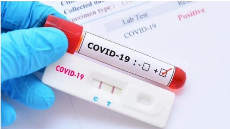 Regjistrohen 8 të vdekur dhe 1348 raste me Covid në Maqedoninë e Veriut