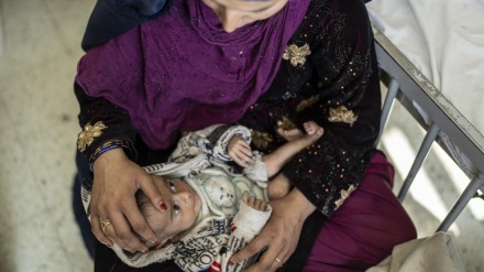  نگرانی از افزایش کودکان مبتلا به بیماری سوء تغذیه در افغانستان 